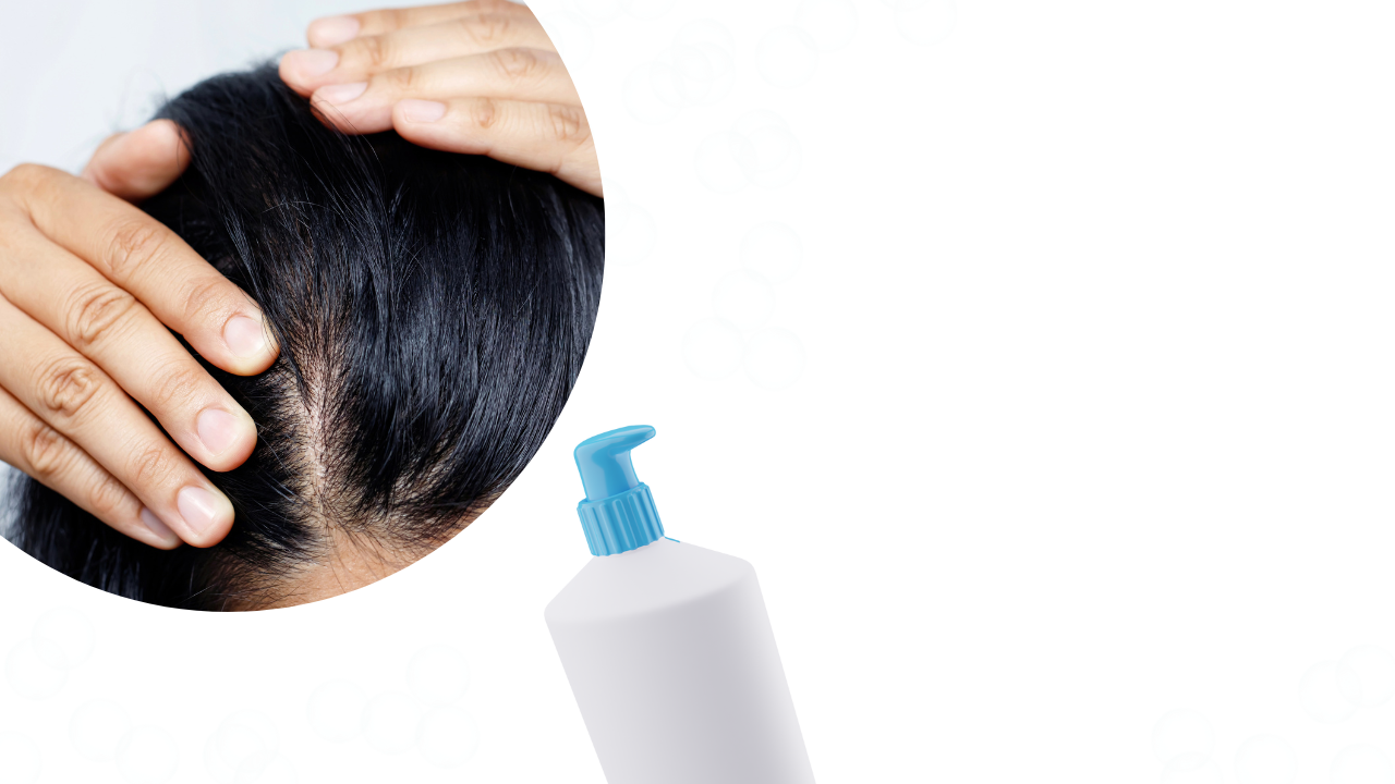 dandruff treatment